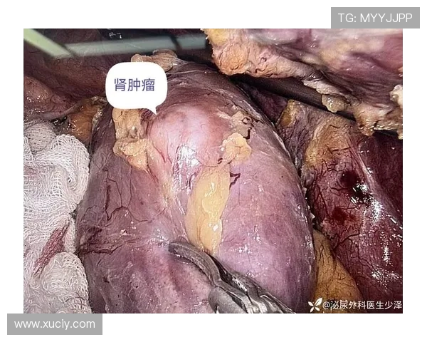 从肾癌病房到商业帝国：韦德如何用三重身份重塑人生(2)